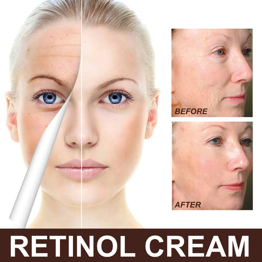EELHOE Retinol Anti-Aging Cream
