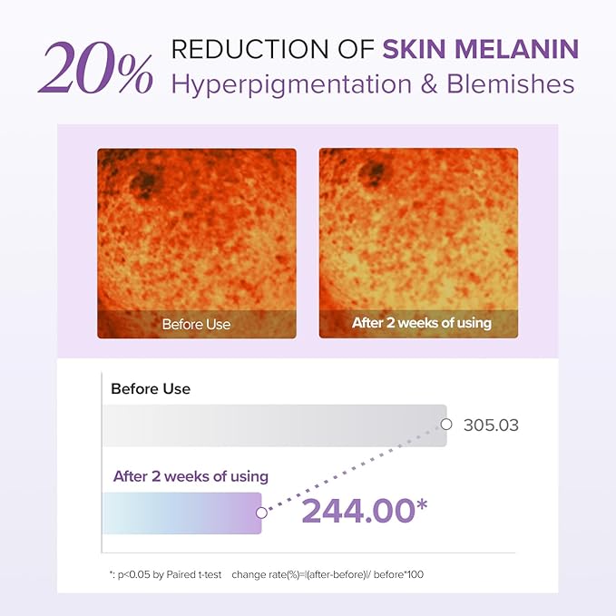 Mary & May – Tranexamic Acid + Glutathione Eye Cream 30ml