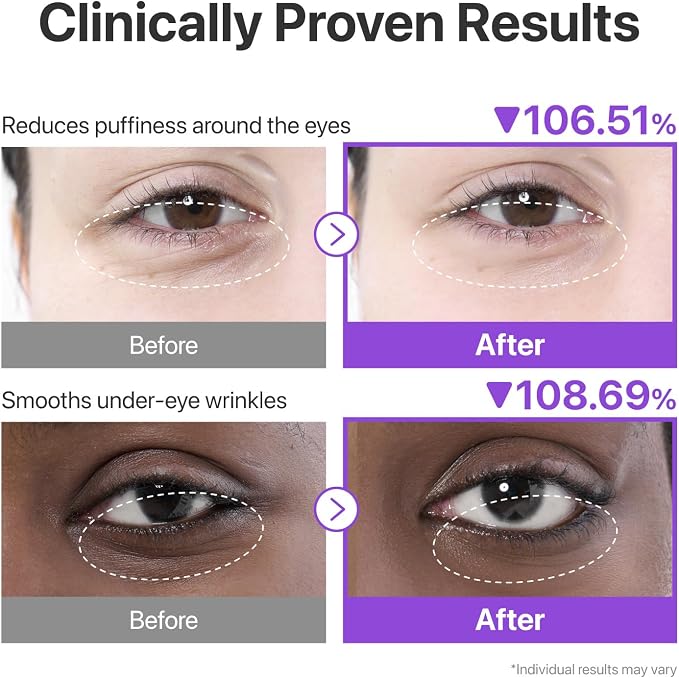 Numbuzin No.9 NAD+ Collagen Under Eye Patches 1 Pair
