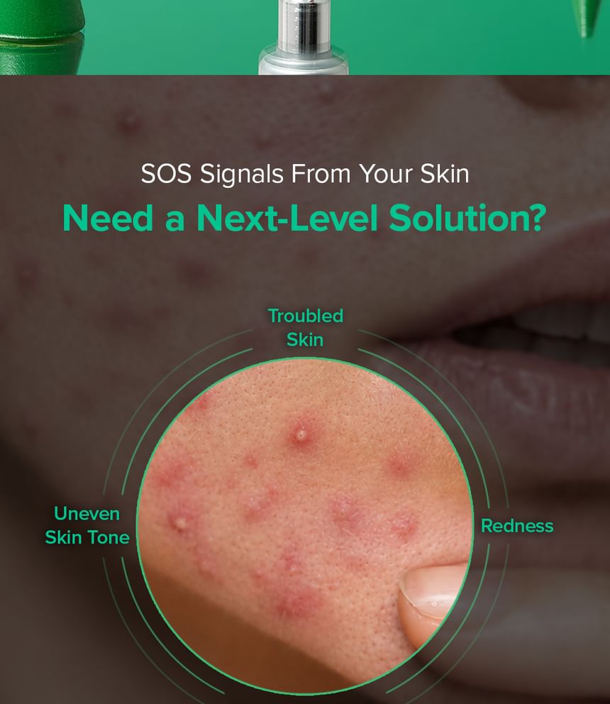Mary&May Spicule Azelaic Acid PDRN Spot Cream 3000PPM