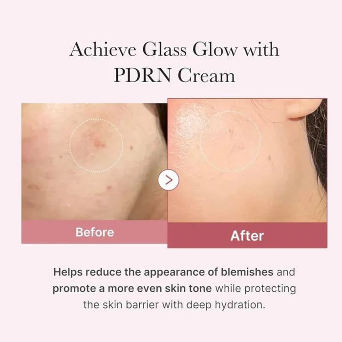 Medicube – PDRN Pink Hyaluronic Moisturizing Cream 50ml