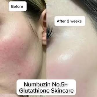 Numbuzin – No.5+ Vitamin Glutathione Dark Spot Laser Cream – 50ml