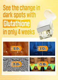 Numbuzin – No.5+ Vitamin Glutathione Dark Spot Laser Cream – 50ml
