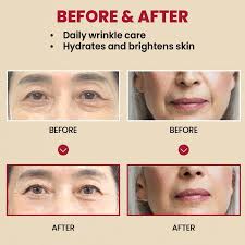 K-SECRET – SEOUL 1988 Cream : Retinal Liposome 1% + Fermented Rice – 50ml