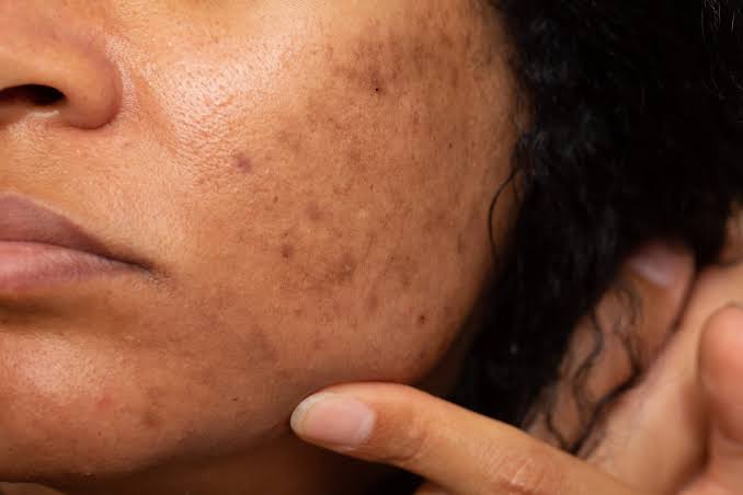Brightening & Pigmentation Routine Bundle
