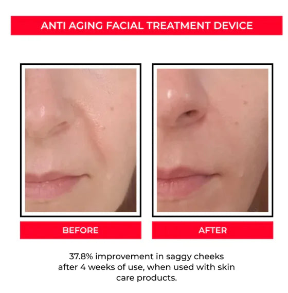 Anti-Ageing Facial Treatment Device